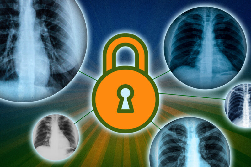 An orange lock icon is in the middle, and lines radiate from it. The lines connect to different circular images of lung x-rays.