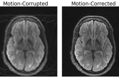 Two side-by-side black and white images of the same brain scan. The one on the left is blurry, and the label "motion-corrupted" appears above it; the one on the right is more clear, and is labeled "motion-corrected."
