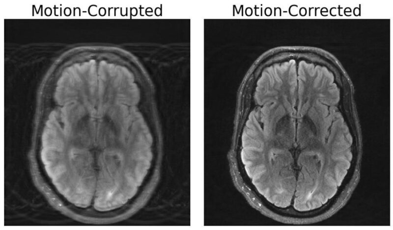 Two side-by-side black and white images of the same brain scan. The one on the left is blurry, and the label "motion-corrupted" appears above it; the one on the right is more clear, and is labeled "motion-corrected."